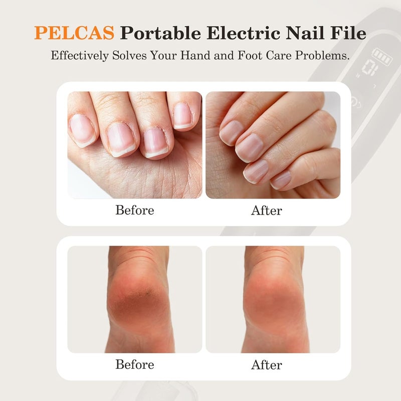 PELCAS Electric Nail Drills, Professional Cordless Nail File Kit with Light, 10 Speeds Manicure & Pedicure Kit for Human, Pet, Thick Toenails, Natural & Acrylic Nails Grey - Image 2
